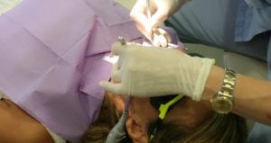 Oral Cancer Screening Procedure