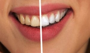 What is cosmetic Dentistry