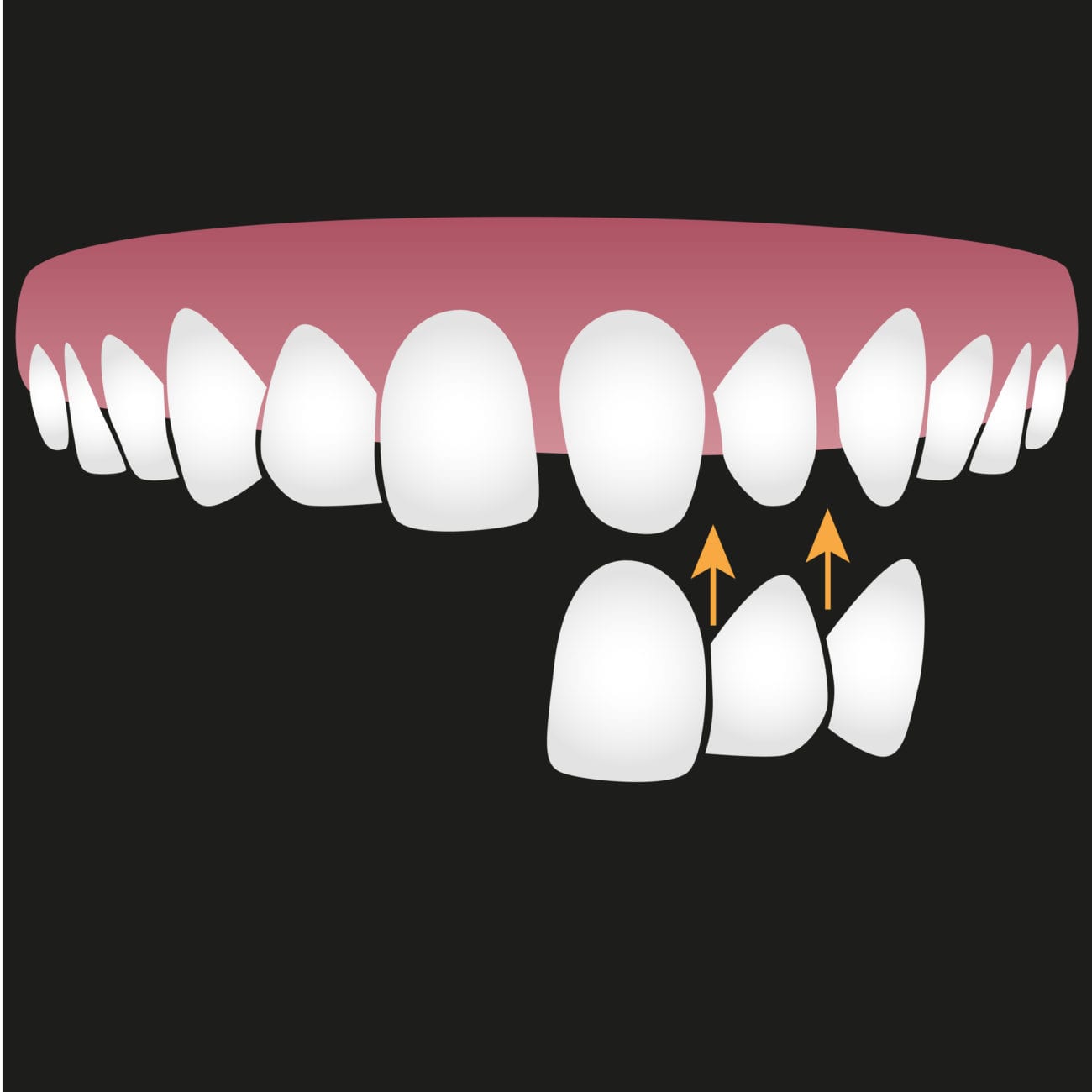 Anchorage Dentist Teeth Whitening