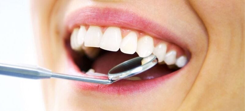 dental bonding Procedure