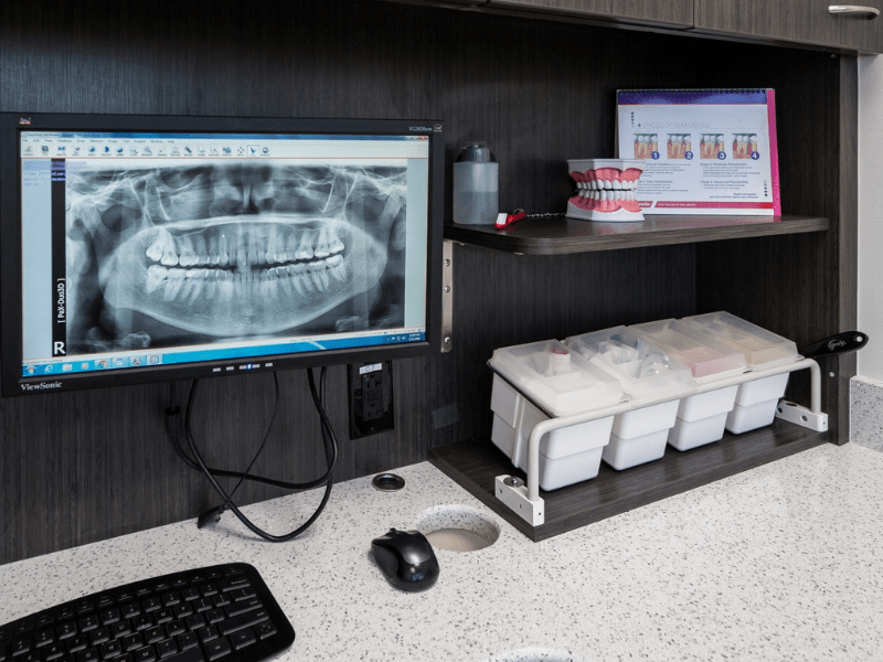 With new and advanced technology, we can diagnose any issue at Mint Dental